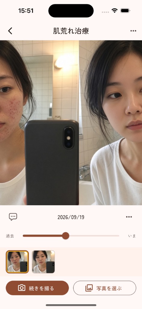 Fadenceで過去と現在の肌の写真を左右に並べて比較している画面